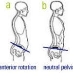 “Tuck” And Pelvic Tilt Talk: Part 2 of 5
